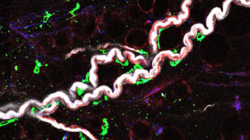 Los macrófagos asociados al nervio (en verde) abrazan los nervios simpáticos (en blanco) en el tejido adiposo visceral.