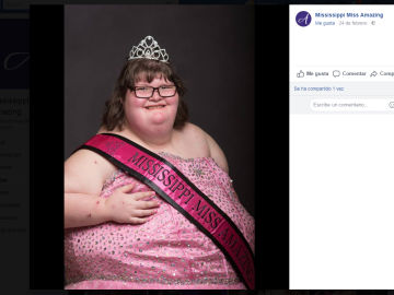 Mississippi Miss Amazing Mississippi Miss Amazing