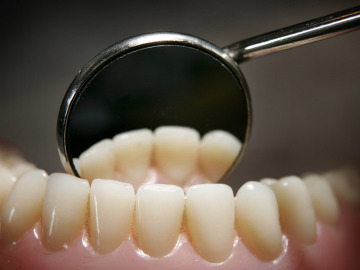 Cuida tu salud bucodental si no quieres tener lesiones