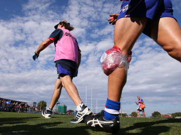 Bursitis