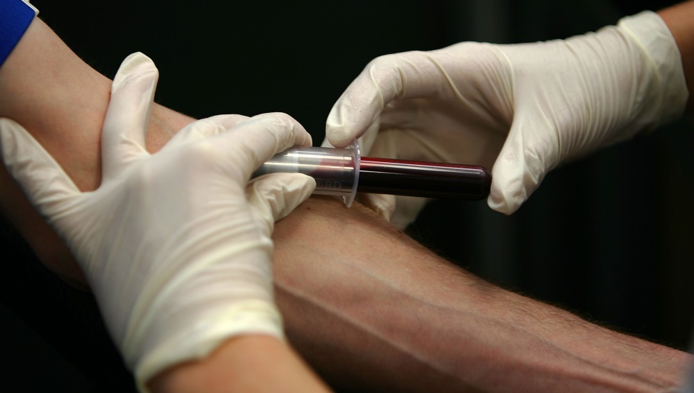 Desarrollan en Estados Unidos el primer dispositivo de extracción de sangre sin agujas