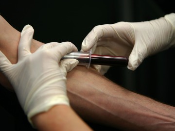 Desarrollan en Estados Unidos el primer dispositivo de extracción de sangre sin agujas Desarrollan en Estados Unidos el primer dispositivo de extracción de sangre sin agujas