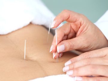 Tratamiento Dermatoma T6 Tratamiento Dermatoma T6